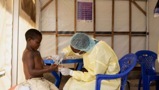 Mpox: Απέτυχε στις δοκιμές φάρμακο για το νέο στέλεχος – Νέα εκτίμηση για τη θνητότητα